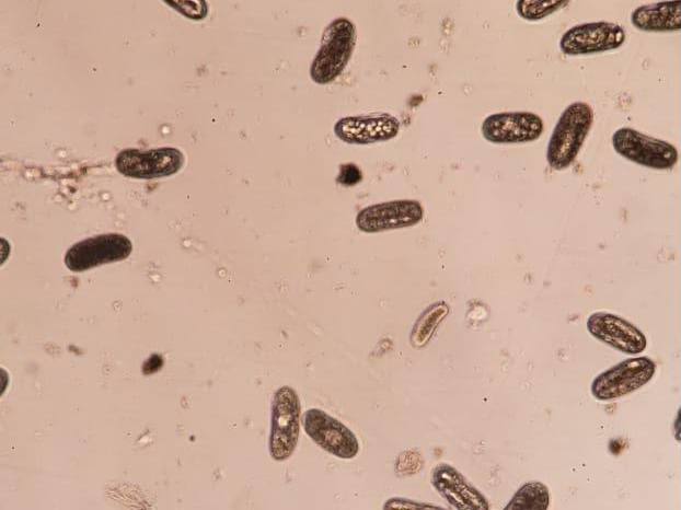 Ovos e nematoides observados ao microscópio, em campo claro